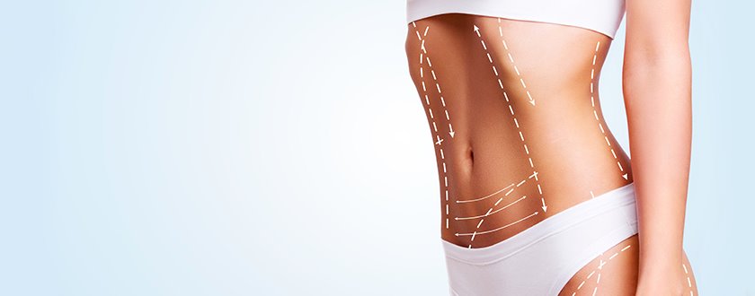 liposuction-kapak_19122019_151837_2